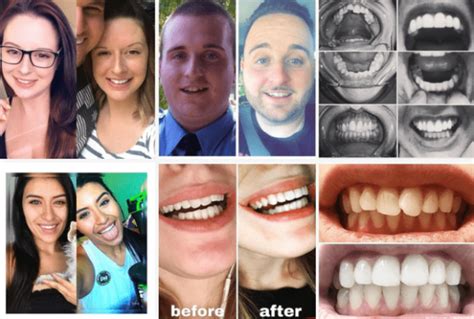 smile direct club results|Quarterly Results .
